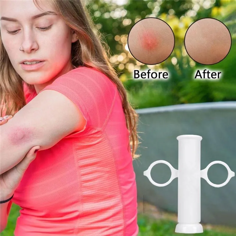 Insect Bite Suction Venom Extr - Outdoor Furniture Hay ulasan dan harga